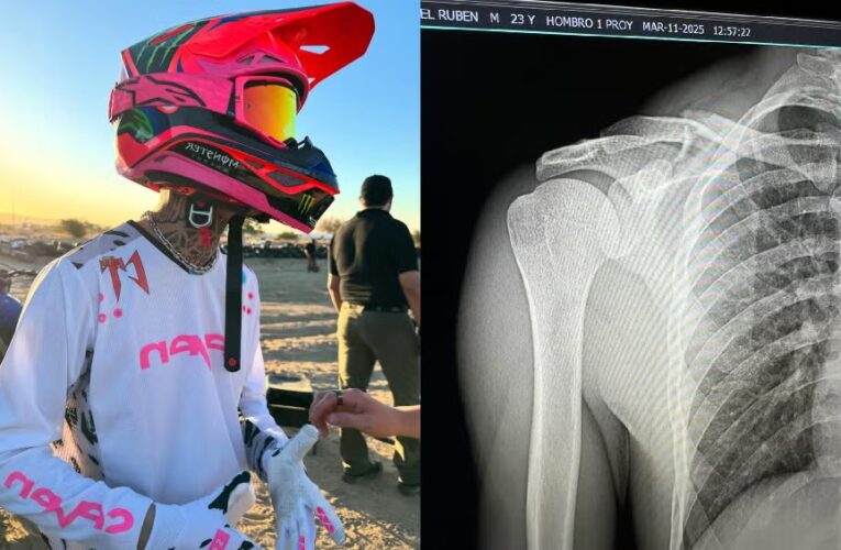 Natanael Cano termina en el quirófano tras accidente en motocicleta
