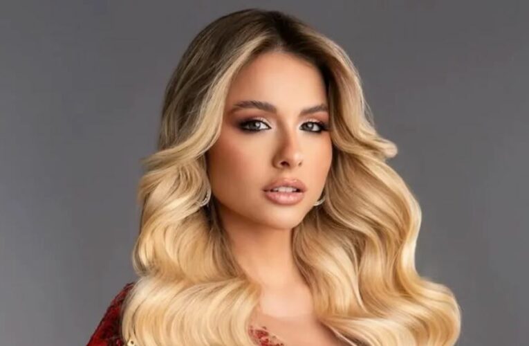 Miss Universo Argentina tiene alopecia; muestra la zona donde no le crece cabello: “Todos tenemos imperfecciones”