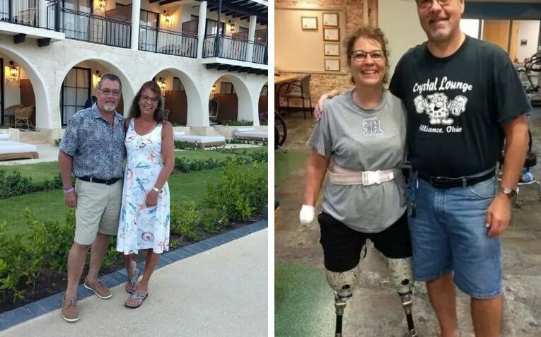 Mujer pierde brazos y piernas tras infección causada por su perro: “fue el peor día de mi vida”