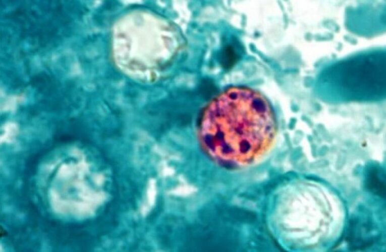 México confirma tres casos de Cyclospora; Salud descarta brote en el país